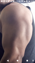 triceps